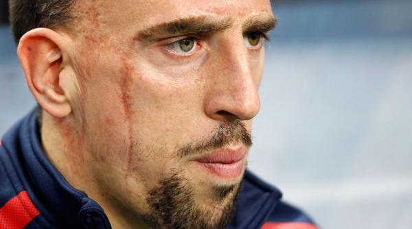 frank ribery da in judecata cnn si cere despagubiri in valoare de 1 5 milioane de dolari