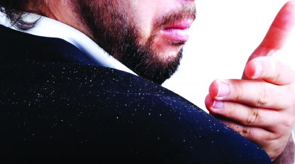 principalele motive pentru care apare matreata de vina sunt inclusiv imunitatea scazuta si dieta fara grasimi