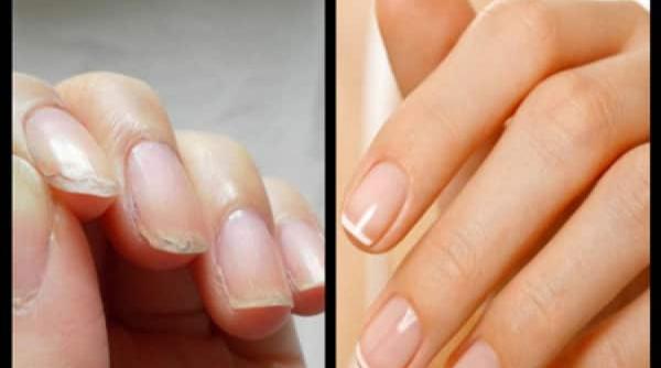 tratamente naturiste unghii exfoliate aceste 3 solutii naturale va vin in ajutor