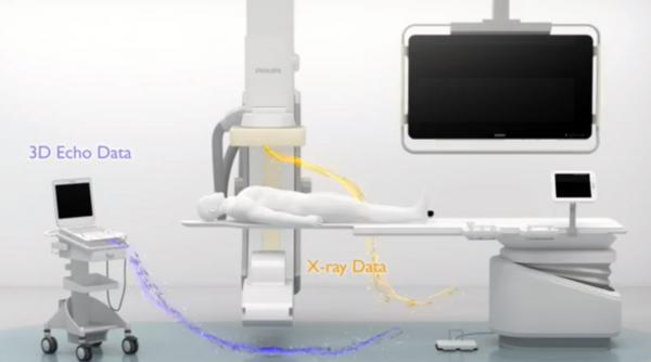 video premiera in europa copii operati pe cord inchis in franta gratie unei tehnologii 3d