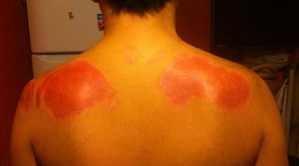 imagini socante postate de un ranit in tragedia din colectiv