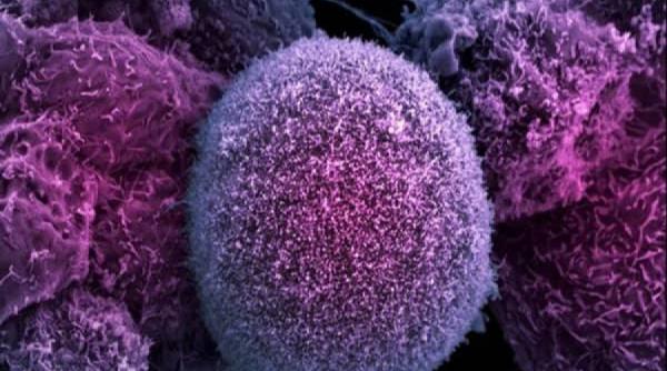 ipoteza tulburatoare cu privire la cauza aparitiei cancerului