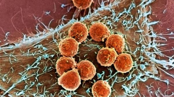 8 simptome pe care nu trebuie sa le ignori pot fi semnele timpurii ale cancerului