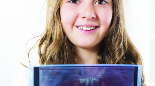 ortodont dintii inghesuiti sunt primii care se strica