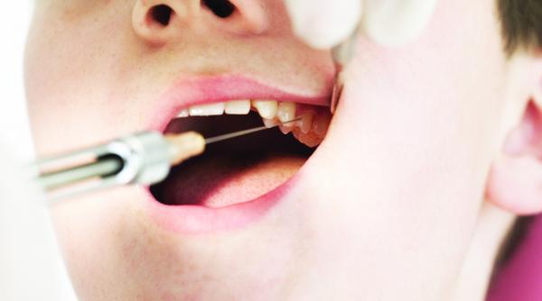 tratament stomatologic cu hormoni de crestere si celule stem