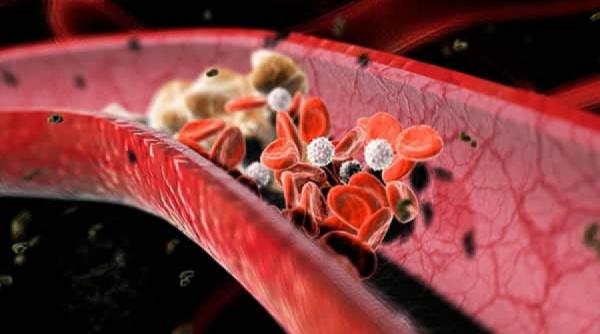 sfatul medicului tot ce trebuie sa stii despre colesterol diagnostic si terapie