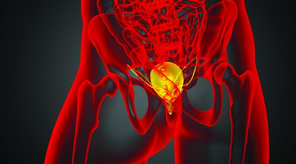 acul de aur radioactiv din prostata