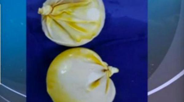 germania o columbianca prinsa pe aeroportul din frankfurt in timp ce transporta cocaina in implanturile mamare