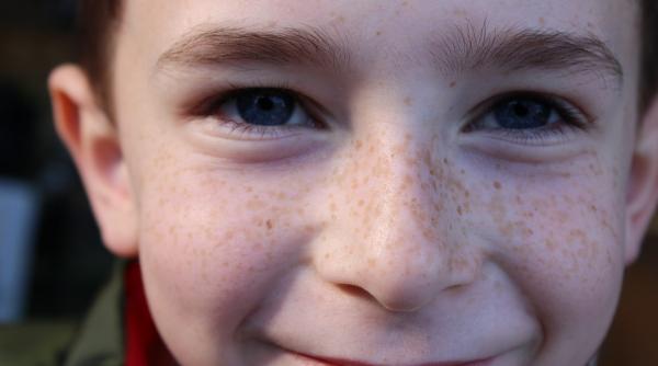 plantele care te ajuta sa scapi de pete si de pistrui