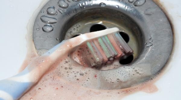 sfatul medicului gingivita cum scapam de inflamatia gingiilor