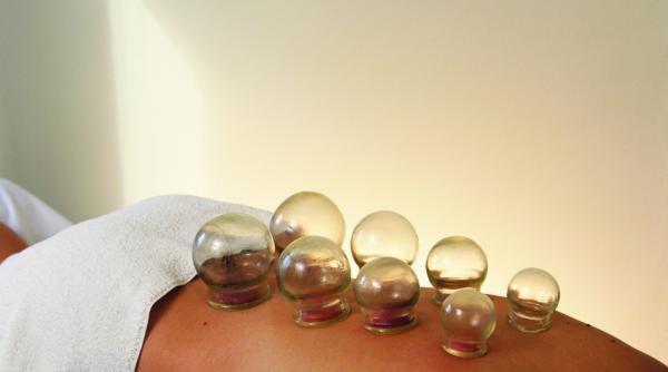 sfatul medicului cum putem trata durerile de spate racelile sau constipatia cu ventuze