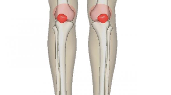 medicii sunt uimiti acest tratament natural combate durerile articulare si previne osteoporoza