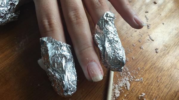 a murit pentru ca isi rodea unghiile cum a fost posibil