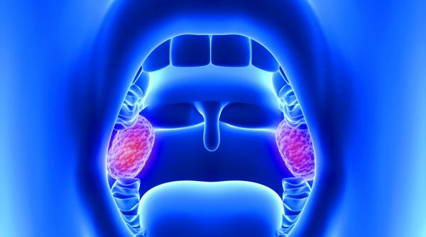 sfatul medicului cand e indicata operatia de amigdalita