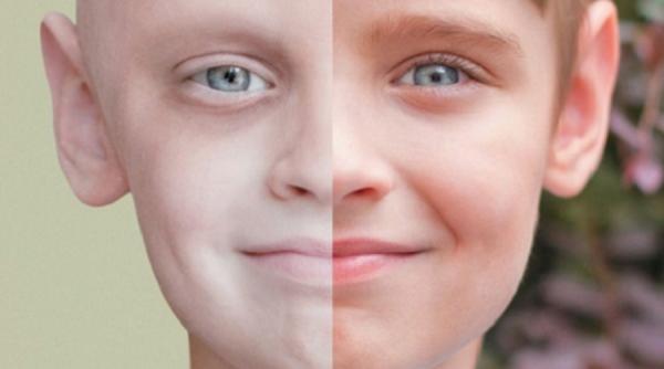 5 remedii naturale anti cancer care chiar functioneaza