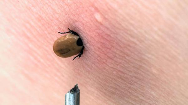 atentie la capuse 120 de prahoveni au ajuns la spital dupa ce au fost muscati de aceste insecte 10 au boala lyme