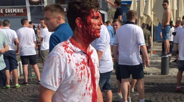 euro 2016 cel putin 35 de raniti dupa incidentele de la marsilia