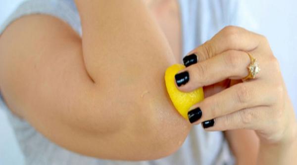 tratamente naturiste 5 solutii care va scapa de coatele negre si crapate