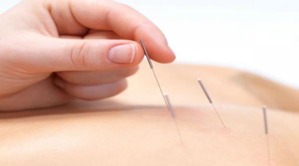 sfatul medicului acupunctura ce este si ce afectiuni trateaza