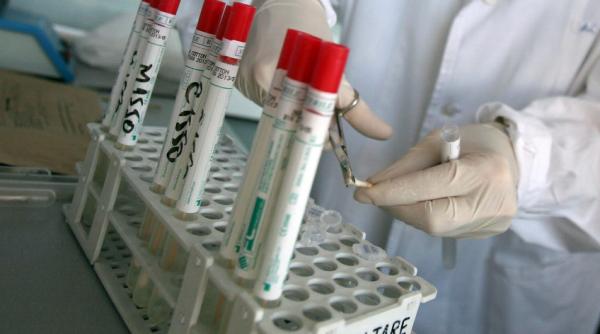 statistica ingrijoratoare numarul celor seropozitivi a crescut cu 57 in judetul cluj