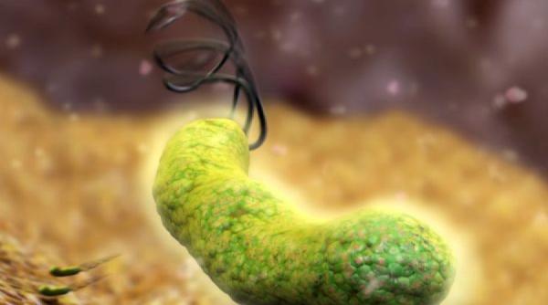 sfatul medicului o bacterie teribila isi face de cap in matele tale tu stii cum sa o identifici si sa o tratezi