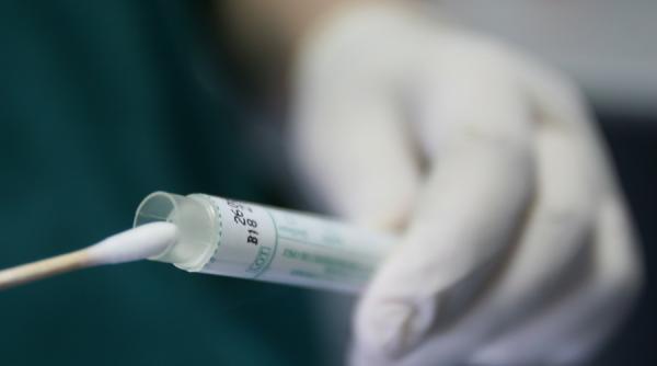 rezultatele controalelor hiv sida