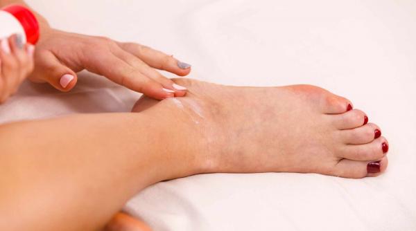 sfatul medicului cum tratam rapid entorsele