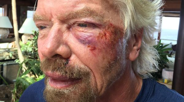 miliardarul britanic richard branson a cazut de pe bicicleta direct in cap