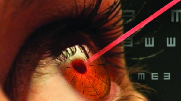 nu oricine poate sa si reduca dioptriile cu laser