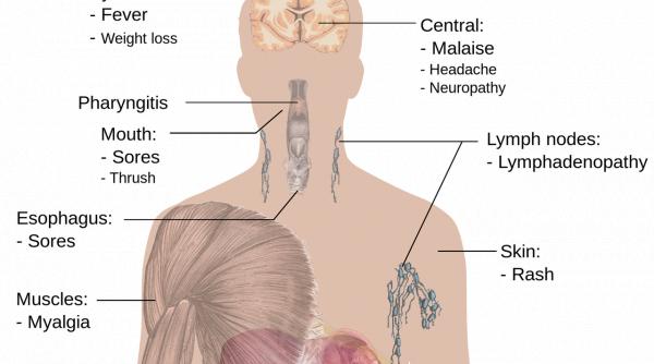 cum sa ti regenerezi rapid ficatul