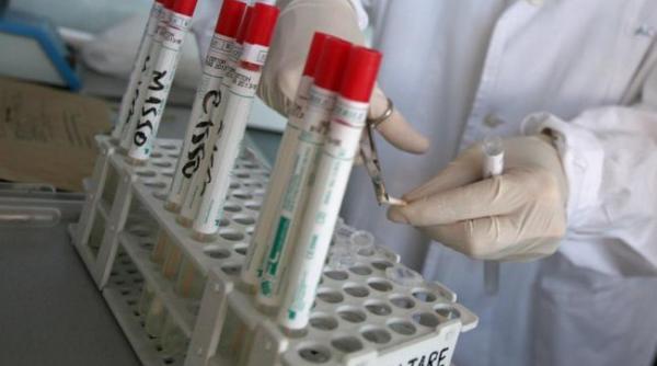 virusul zika au fost gasite fragmente genetice de zika in ochi si lacrimi de soareci de laborator infectati