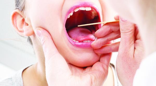 amigdalele si apendicul fac parte din sisteme de aparare imunitara