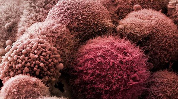 sfatul medicului diagnosticarea stapanirea si tratarea cancerului