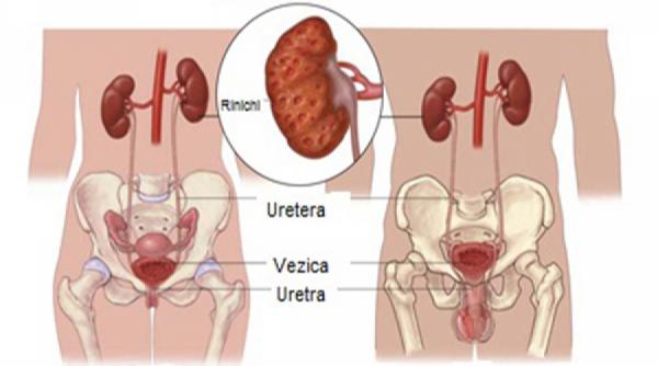 sfatul medicului totul despre pielonefrita cauze simptomatologie terapii