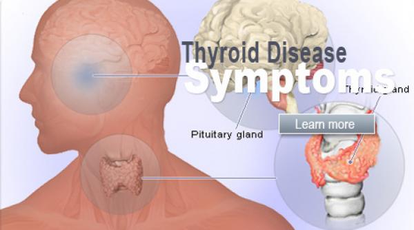 semne ca nu slabesti sau nu te ingrasi din cauza tiroidei