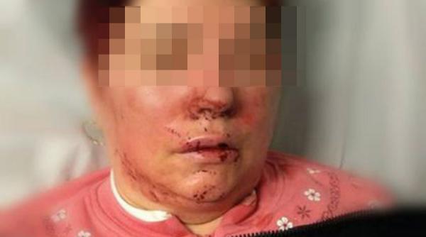 alerta in botosani o banda de talhari bat si le jefuiesc femeile