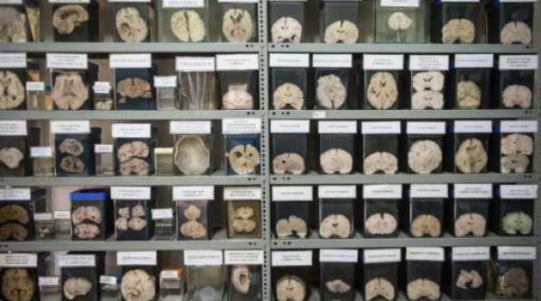 peru muzeu dedicat observarii unor creiere bolnave