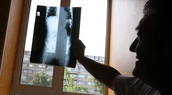 in galati numarul persoanelor cu viroze respiratorii si pneumonii in crestere