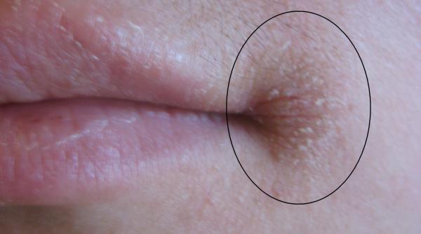 va confruntati cu aceasta problema iata ce afectiuni grave ar putea indica