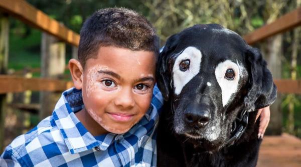 un baiat de 8 ani cu o boala de piele rara a cunoscut un caine care sufera de aceeasi afectiune