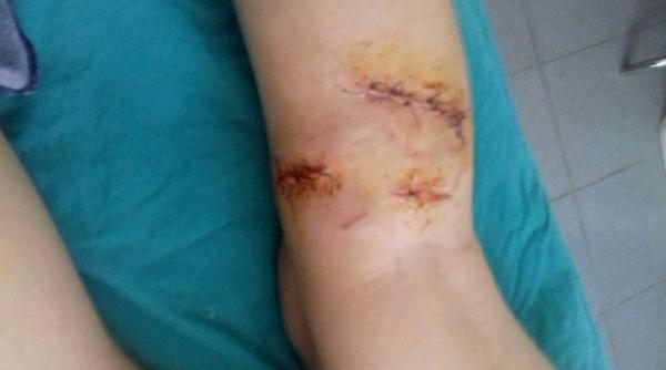 7 caini au sfasiat un copil intr un sat sibian