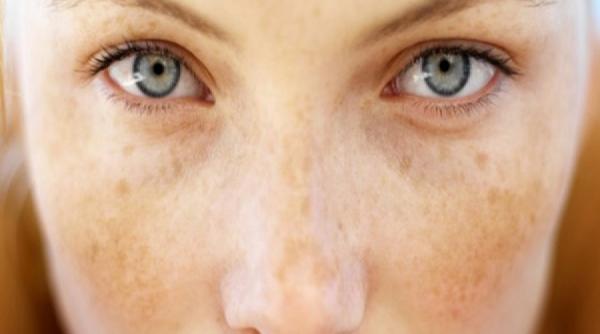 cum scapi de pistrui metode naturiste deosebit de eficiente