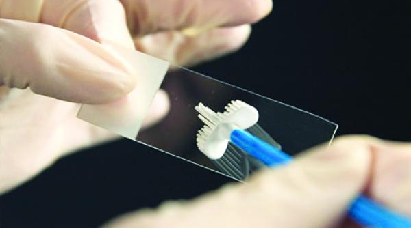 cancerul care face ravagii in romania