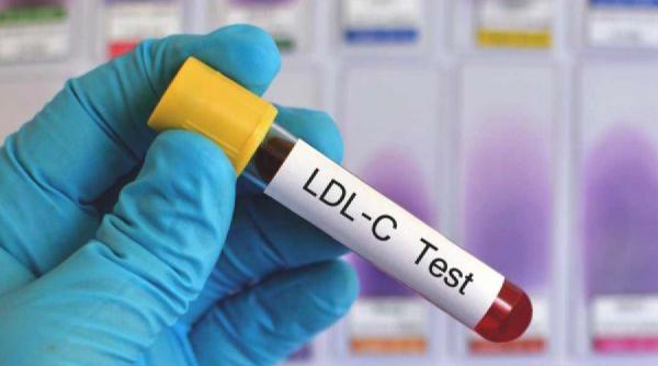 cum sa ti reduci colesterolul fara medicamente pasii pe care trebuie sa ii urmezi iti curata si arterele