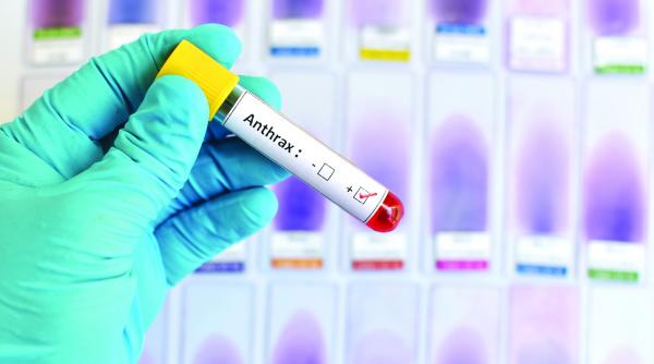 alerta la botosani doua persoane cu antrax