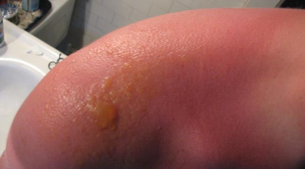 victima a valului de caldura din uk