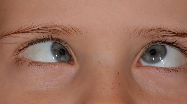 cum scapam ieftin de punctele negre