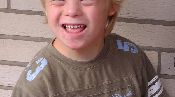 tara unde sindromul down aproape a disparut