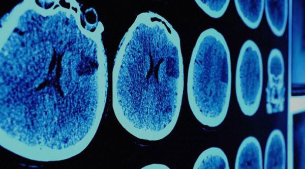 descoperire uimitoare a cercetatorilor in lupta impotriva cancerului