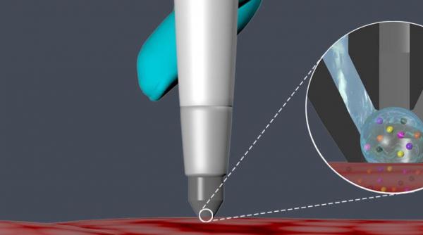 o sonda de marimea unui stilou detecteaza celulele canceroase in 10 secunde